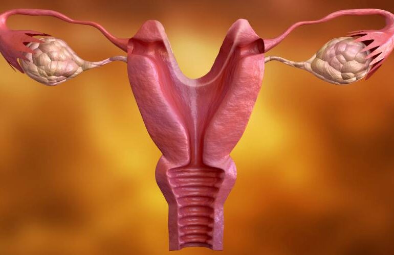 nilay-karaca-endometriozis